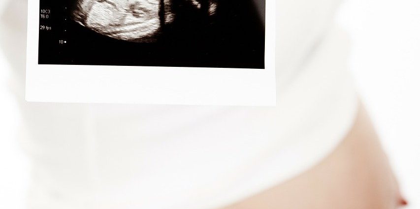 Apraty USG - badania diagnostyczne z ultrasonografem