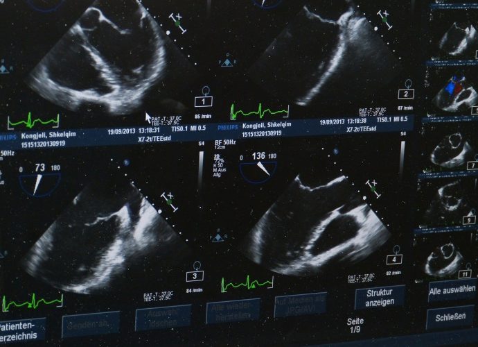 Nowoczesna ultrasonografia w medycynie